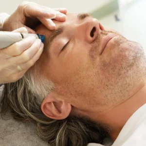Limpieza Facial con Punta de Diamante